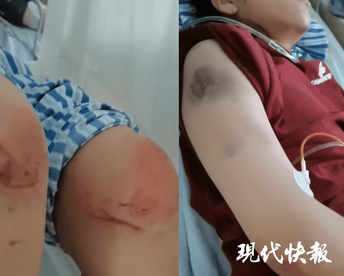 皇冠信用网最新地址_石家庄被家暴女子驾车逃跑致丈夫身亡皇冠信用网最新地址，一审以故意杀人罪获刑11年